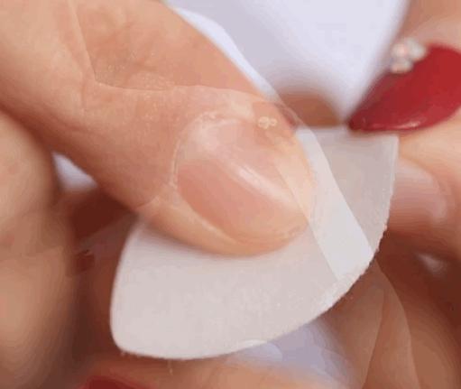 眉间纹和法令纹除皱针能去掉吗,嘴角纹法令纹抬头纹国货推荐