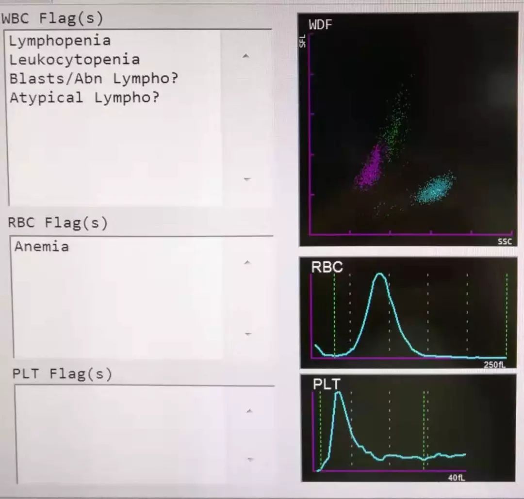 全血细胞减少就是白血病,全血细胞减少性白血病