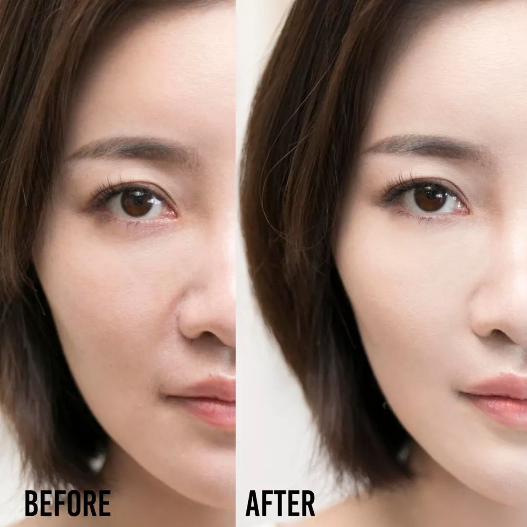 敏感肌急救,为什么突然成为敏感肌