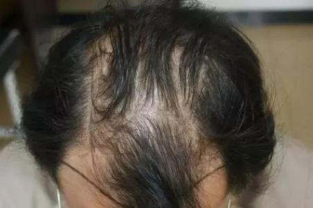 生姜防脱育发洗发水推荐,老姜王生姜防脱育发洗发水300ml