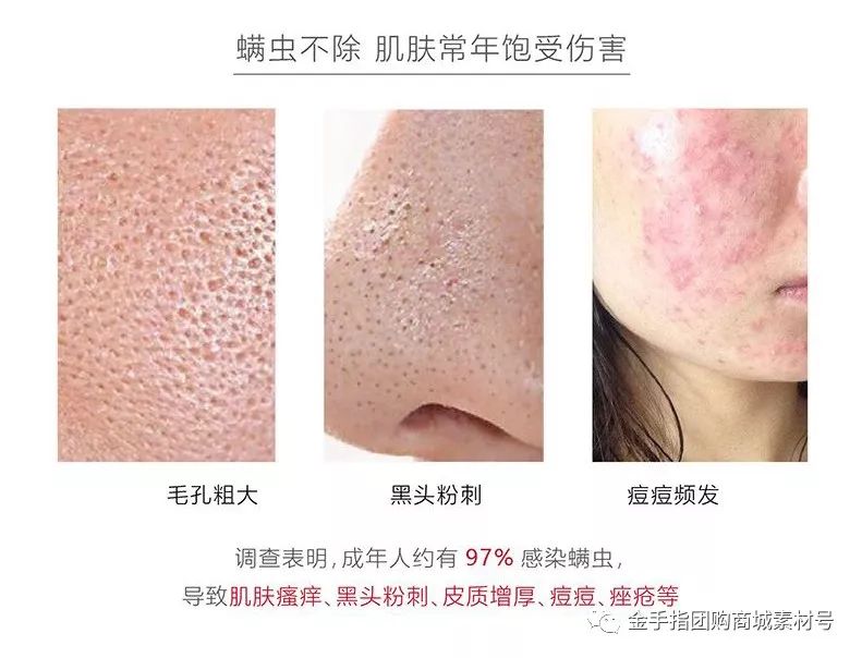 金手指线上团购,金手指团购套装