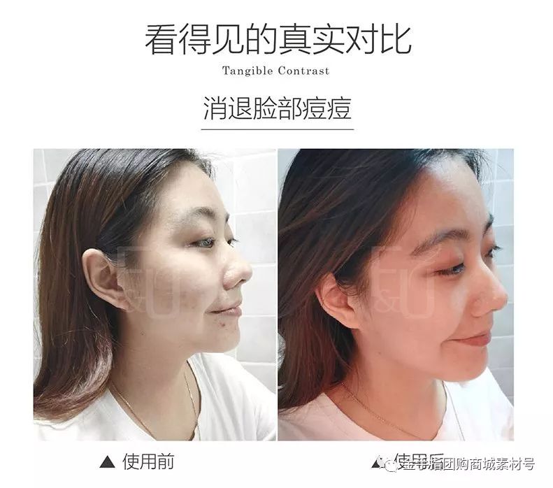 金手指线上团购,金手指团购套装