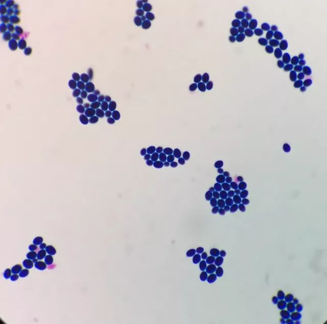 女儿大便里面有霉菌,孩子粪便里有霉菌