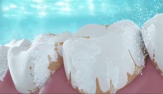 美白牙膏一刷就好,美白黄牙烟渍最好的牙膏