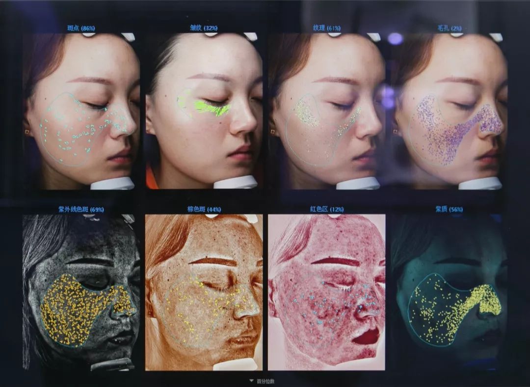 小茂肌诊室∣记一次网红咖啡店里的特别出诊