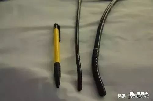 胃肠镜是不是胃镜和肠镜一起检查,胃肠镜是包括胃镜和肠镜吗