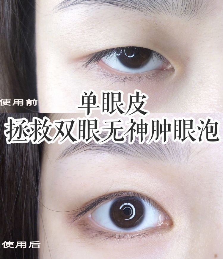 适合熬夜的护眼神器,眼睛疲劳用什么护眼神器