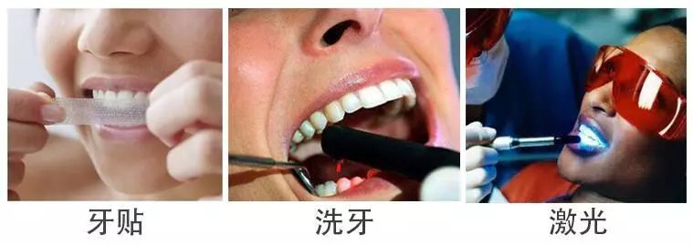 去除黄牙牙垢的牙膏,去口臭黄牙牙垢的牙膏