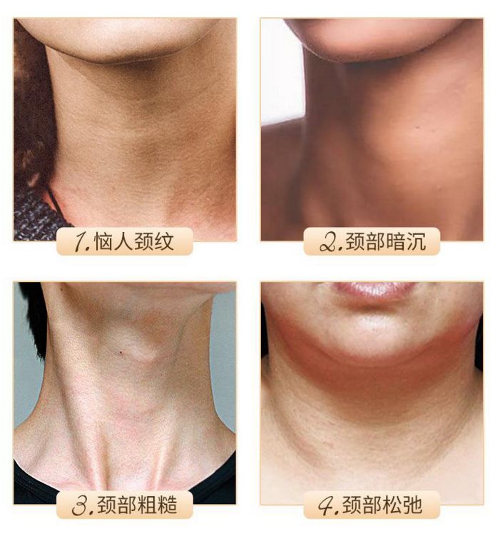 这款急救弹性蛋白贴，每天一片赶走干纹，还你天鹅美颈