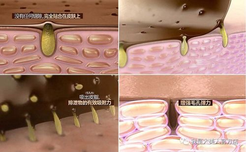 画面极度舒适！十几年顽固老黑头，30秒彻底连根拔起！毛孔畅快呼吸原来是这种感觉