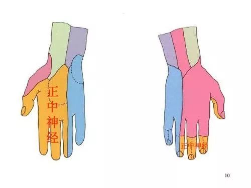 正中神经损伤手指麻痛怎么办,正中神经损伤影响正常活动吗