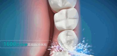 洗牙神器是真的管用,洗牙神器去牙结石永久有效果