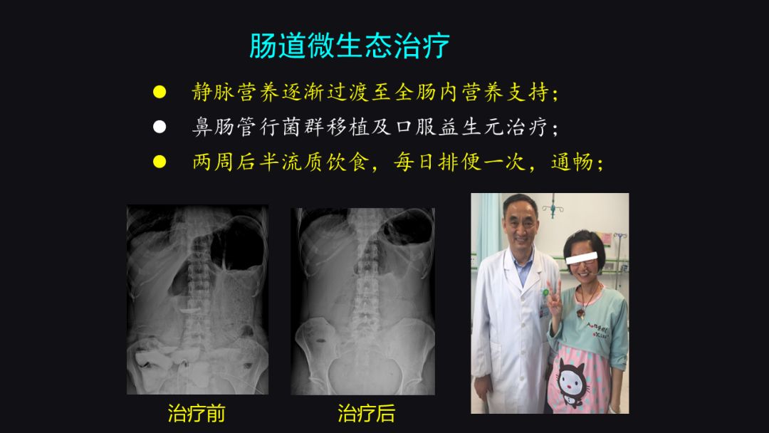 李宁奋斗历程英文版,李宁夜以继日