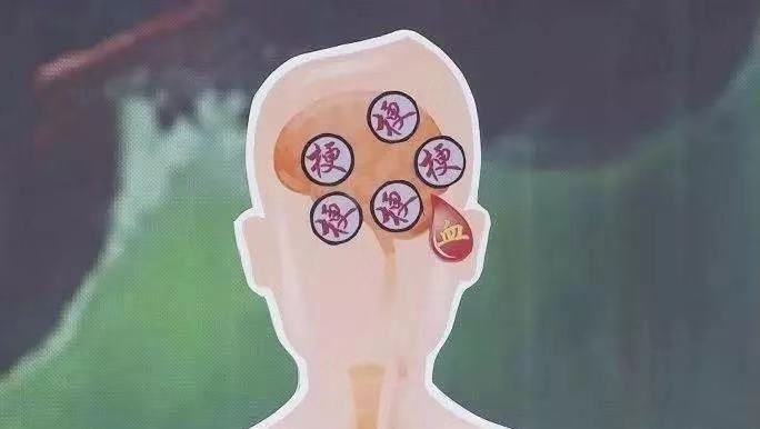 出现这4个征兆可能是血管堵住了,三根血管严重堵塞危险吗