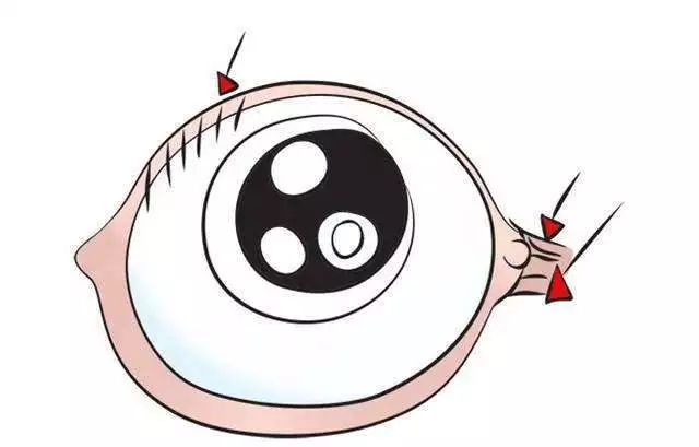 这些表现巨伤娃的眼!你却不知道?