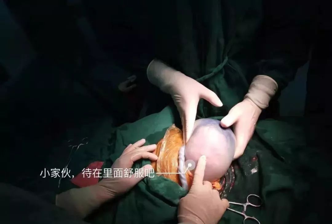 36岁的孕妇产下一“透明蛋”，里面的男宝宝还在动
