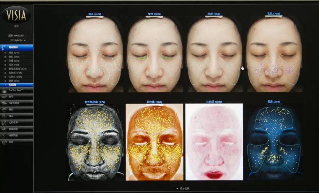 肌诊室修复,肌诊室水光肌挑战