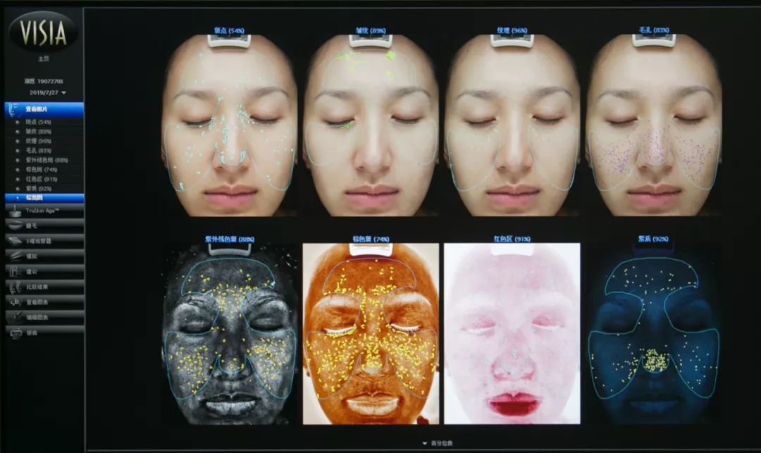 肌诊室水光肌挑战,肌诊室修复