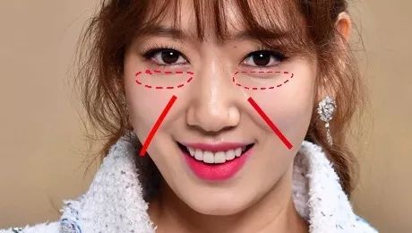 法令纹和眼纹怎么才能有效改善,法令纹贴眼贴有用吗