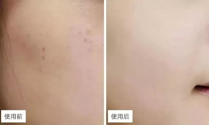你皂吗?ta凭借淡斑美白效果,被外国姑娘囤疯了