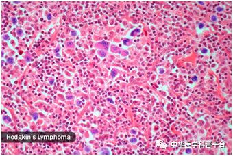 盗汗的可能原因,男人盗汗的原因