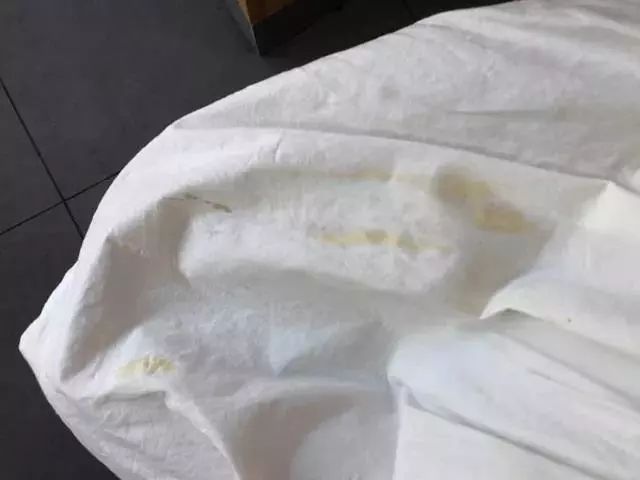 衣服上有霉斑怎么洗才能洗掉,衣服去霉斑最快最狠的几种方法