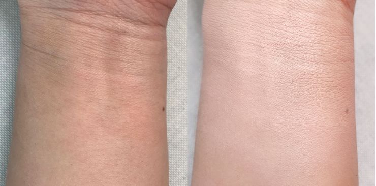 11款热门遮瑕合集,遮瑕笔强力遮斑测评