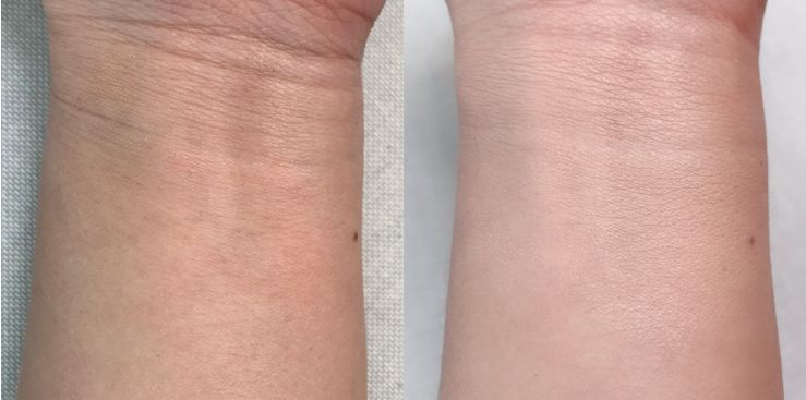 11款热门遮瑕合集,遮瑕笔强力遮斑测评