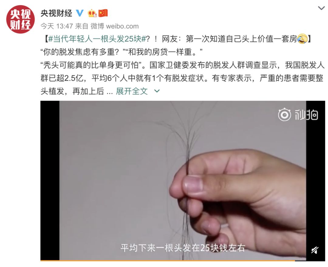 一根头发值25块,一根头发价值多少钱