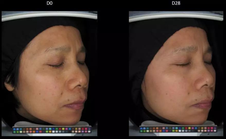 科学合理变白教程,变白最全攻略