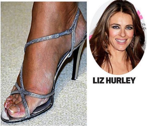 足部护理保湿防干裂去死皮,干燥足部保湿霜