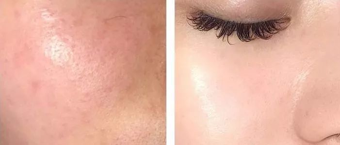 澳皙可涂抹面膜,澳皙可海藻面膜适合什么肤质