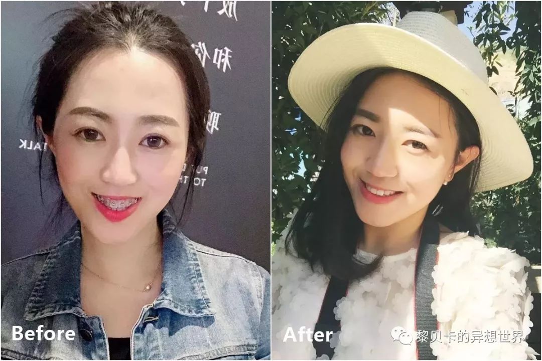 最短只要一年，这件事做对了堪比整容