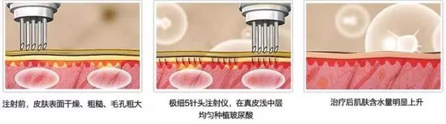 盲测|微整不急!先试试黑科技抗老面霜