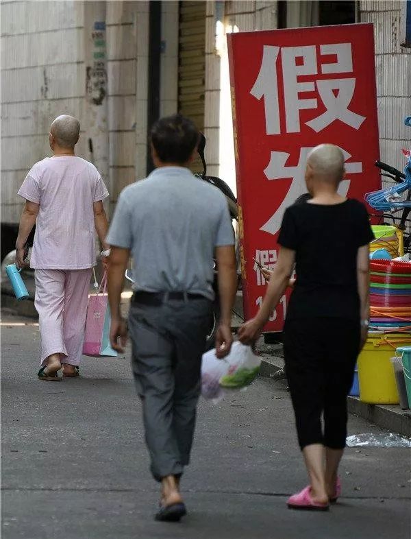 癌症患者挂尿袋和屎袋,患癌人身上带着尿袋