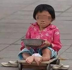 眼球被挖的人后续,眼球被挖了一个洞还能恢复吗