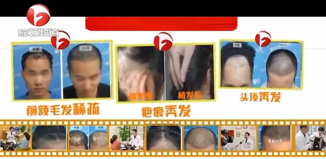报道来了！28岁小伙“秃”成50岁？过年前抓紧……芜湖全面启动
