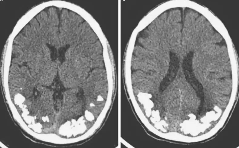 神经影像,神经影像解剖图