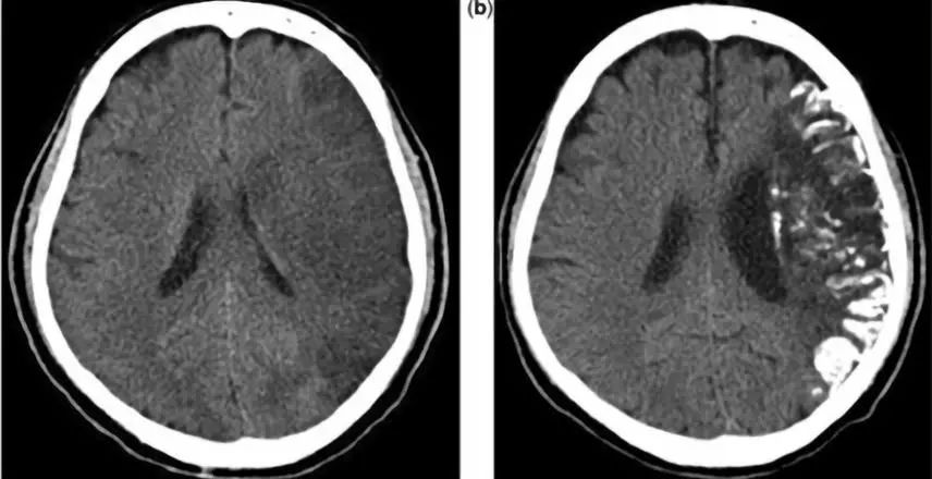 神经影像,神经影像解剖图