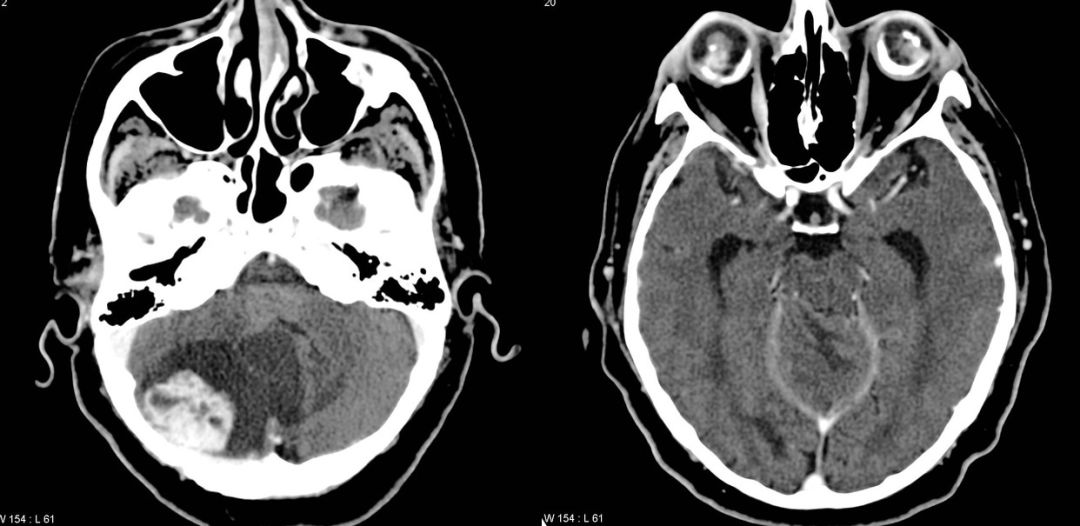 神经影像,神经影像解剖图