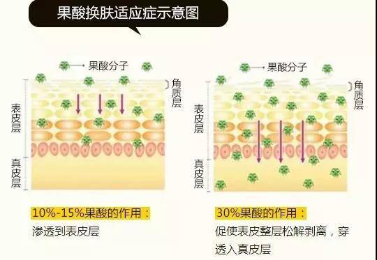痘印两三年了也去不掉怎么办,痘印好几年了去不掉怎么办