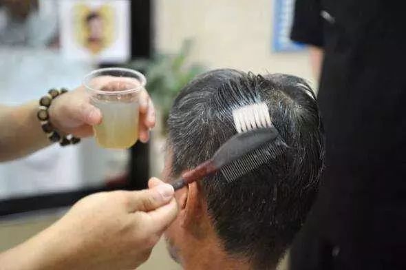 「小心」眼睛肿成缝，头皮溃烂…一周接诊20多例！当心，年前很多人爱做这事