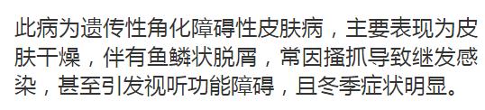 皮肤病一到冬天就痒,冬天皮肤痒是什么皮肤病