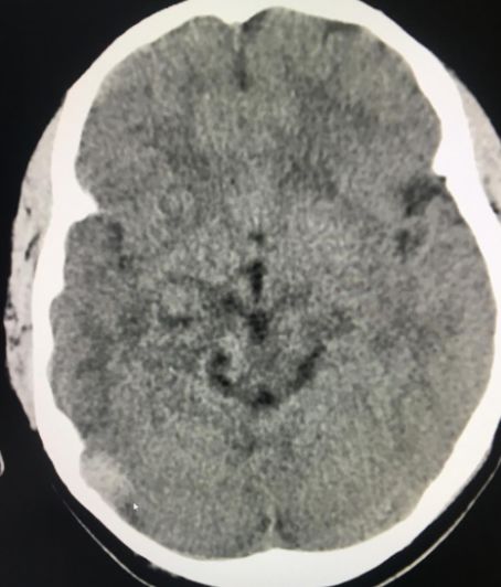 蒙自第一人民医院中医科,蒙自市中医院专家门诊