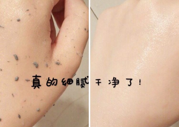 脸上搓出3斤泥!难怪又黄又暗又黑头!10秒给脸蛋“剥壳”,厉害