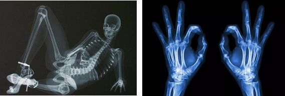 核磁共振与ct哪个辐射更高,脑ct与脑核磁共振哪个辐射大