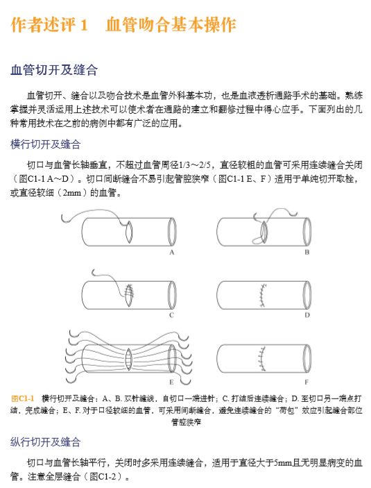 血液透析全套书,血液透析血管通路书籍推荐