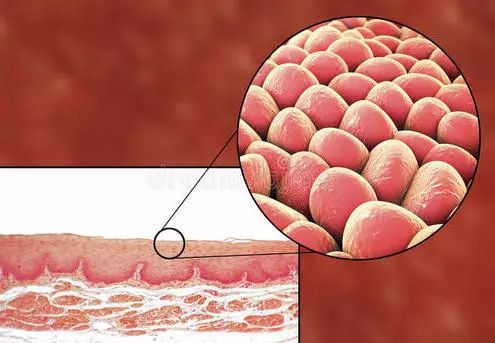 反了！人体“铠甲”变“僵尸”，这种癌症，忽视就晚了