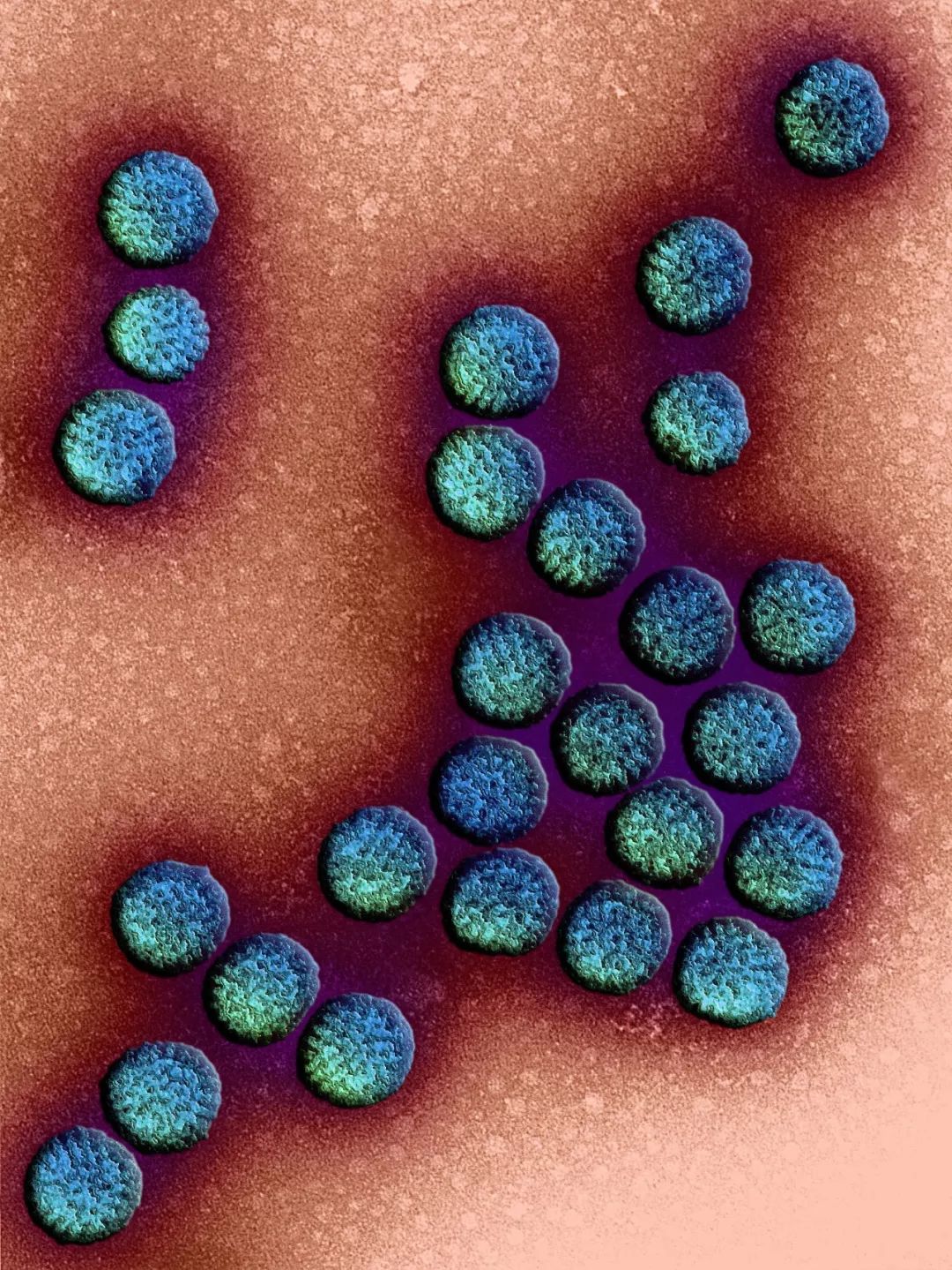 鍋囧鐥呮瘨鎰熸煋浜嗕綘,鍋囧鐥呮瘨鎰熸煋浜嗘垜