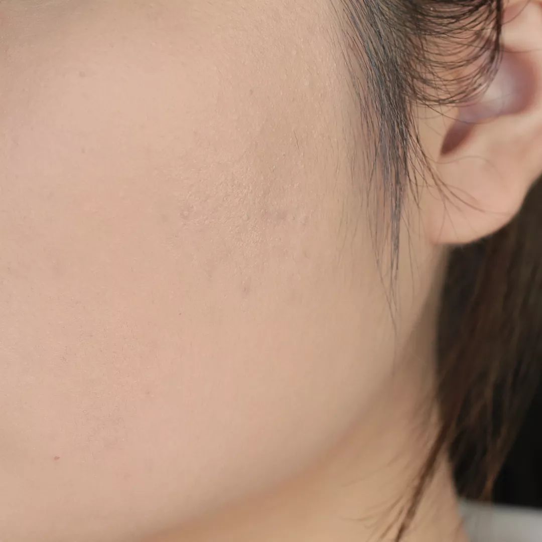 平价气垫遮瑕持久排行榜前十名,8款热门平价遮瑕测评瑕疵皮救星